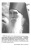 Scan260